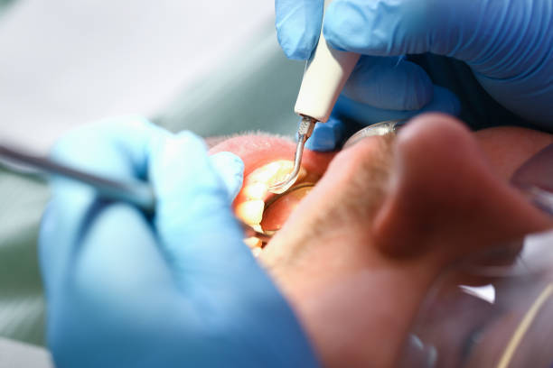 Best Pediatric Emergency Dentist in Littleton Common, MA